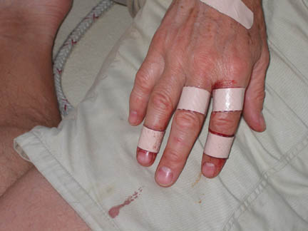 Photo200600214Hand.jpg - 35911 Bytes